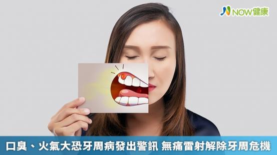 口臭、火氣大恐牙周病發出警訊 無痛雷射解除牙周危機