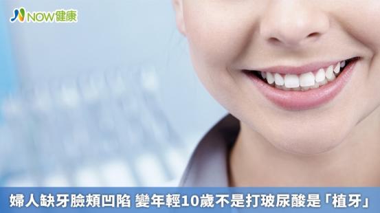 婦人缺牙臉頰凹陷 變年輕10歲不是打玻尿酸是「植牙」